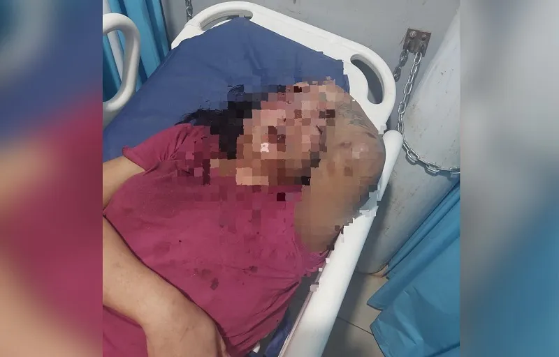 Transpuan di Kendari Aniaya Teman dengan Asbak, Picu Luka Serius 3 Transpuan di Kendari Aniaya Teman dengan Asbak, Picu Luka Serius