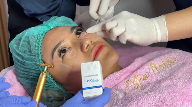 Perawatan Kulit Korea Selatan Juvelook Kini Hadir di Citra Medika Kendari