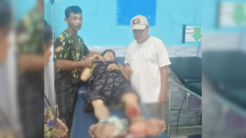 Buang Air Besar di Kali, Warga Mubar Digigit Buaya 1 Buang Air Besar di Kali, Warga Mubar Digigit Buaya