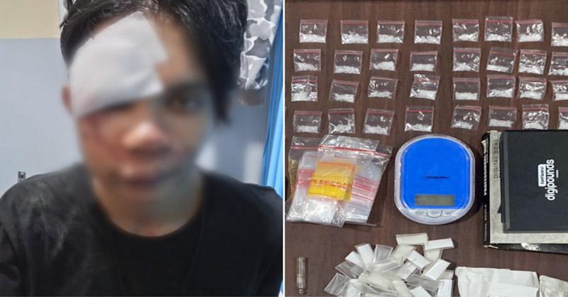 Berawal dari Kecelakaan Tunggal, Polresta Kendari Ungkap Korban Ternyata Pengedar Narkoba 1 Berawal dari Kecelakaan Tunggal, Polresta Kendari Ungkap Korban Ternyata Pengedar Narkoba