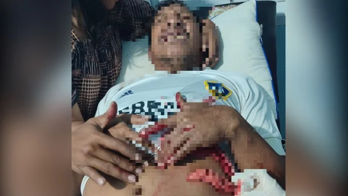 Pria di Muna Barat Tikam Warga Gegara Ditegur Geber Gas Motor Tengah Malam 1 Pria di Muna Barat Tikam Warga Gegara Ditegur Geber Gas Motor Tengah Malam