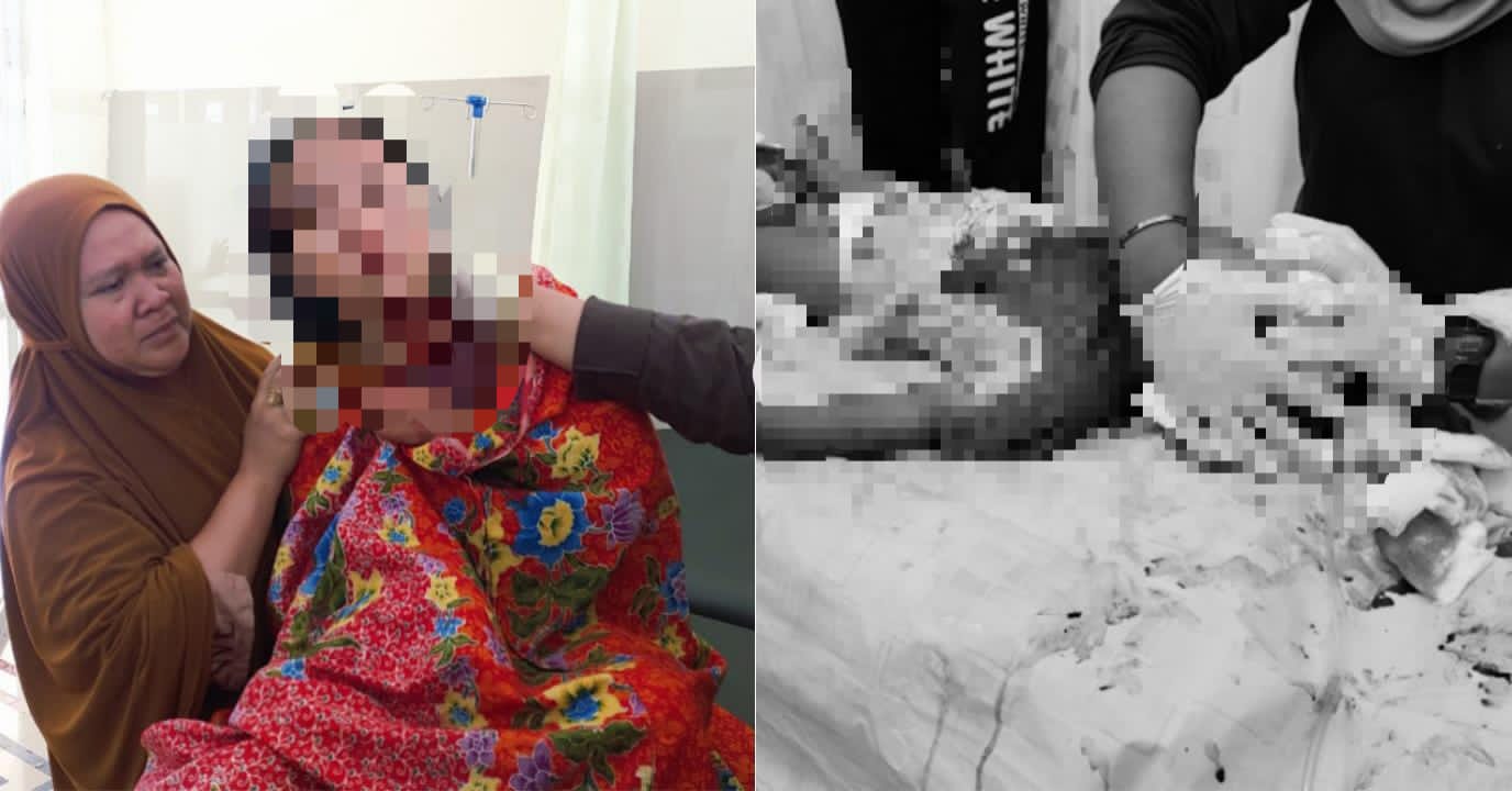 Ayah di Konawe Bacok Istri dan Anak Berusia 2 Tahun, Korban Kritis